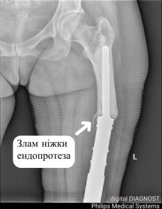 Історії пацієнтів