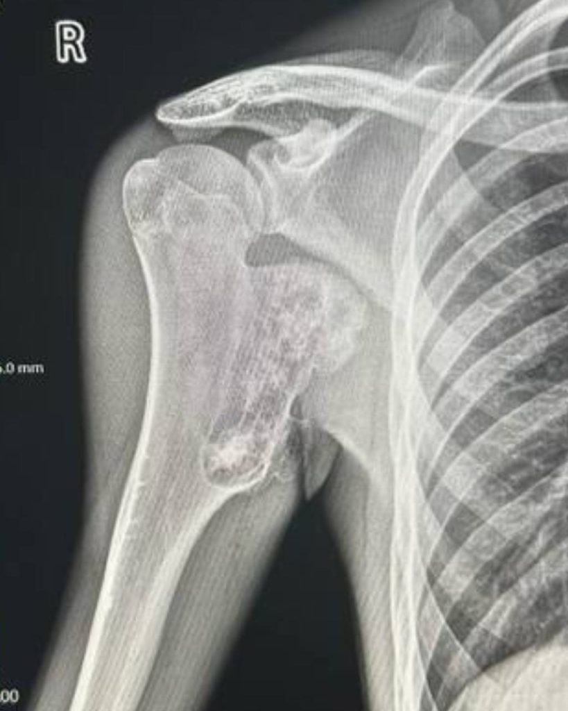 Історії пацієнтів