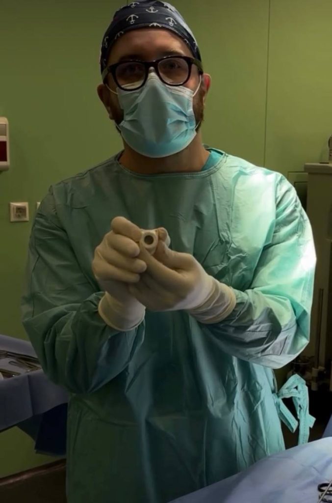 Венозний порт при хіміотерапії: навіщо він потрібен і чому це стандарт лікування.